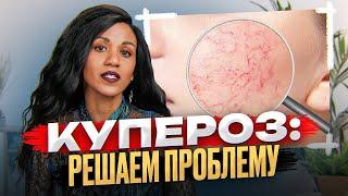 Купероз: решаем проблему // Сосуды на лице // Красное лицо // Телеангиэктазии