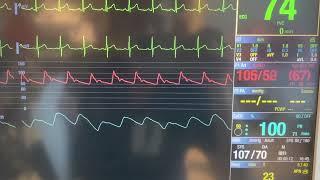 ICU Bedside Monitor Tutorial