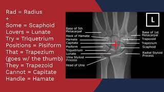 X-ray Positioning Evaluation - PA Wrist