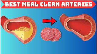 The BEST MEAL to CLEAN Out Your ARTERIES