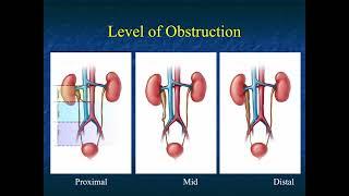 Abdominal Pain in the ED: GU Pathology - Part 1