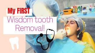 OUCH! 2 Wisdom teeth removed! | Malvika Sitlani