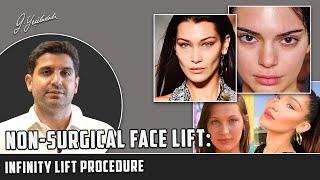 Non-Surgical Face Lift Method: Infinity Lift Procedure I M.D Güray Yeşiladalı #infinitylift