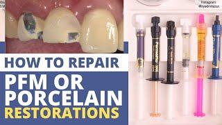 How to Repair PFM/Porcelain Restorations