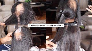 ALOPECIA? NO PROBLEM! HOW I COVERED ALOPECIA WITH NATURAL HAIR SILK PRESS!