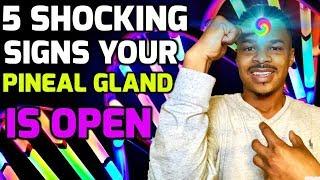 5 SHOCKING Signs Your Pineal Gland is Open ( YOUR 3rd Eye IS ACTIVATED!!!)