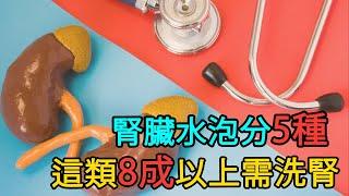 腎臟水泡分五種 這類患者8成以上需洗腎｜好心肝·好健康