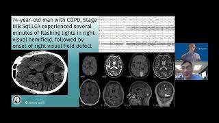 Neuro ophthalmology Guru: Unusual cause of flashing light