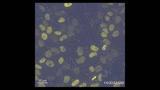 Microscopy Imaged Mammalian Cells in CO2 Independent Media for 24h with BC43 Benchtop Microscope