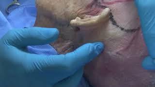 1-on-1 Facial Anatomy for Threads Neck