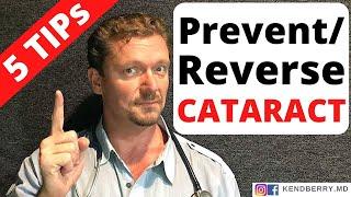 Prevent/Reverse CATARACTS with These 5 Tips