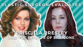 Priscilla Presley Plastic Surgery: Illegal Silicone + Fake Doctors = Botched