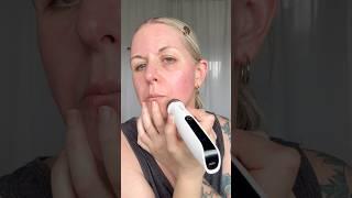 I Microneedled My Face at Home… AGAIN  Watch before you try #drpen