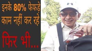Cancer survivor is alive for poor and helpless people |  NOOK POST