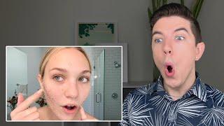 Specialist Reacts to Maddie Ziegler's Skin Care Routine