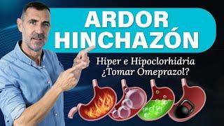 ARDOR e HINCHAZÓN de ESTÓMAGO   Hipoclorhidria, Hiperclorhidria y Omeprazol