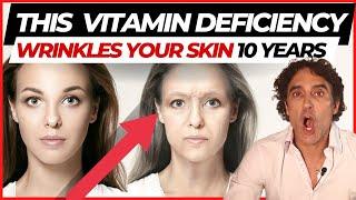  THIS ONE VITAMIN DEFICIENCY WRINKLING YOUR FACE  // Vitamins For Skin Update