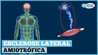 O QUE É ESCLEROSE LATERAL AMIOTRÓFICA (ELA)? SINTOMAS, DIAGNÓSTICO, CAUSAS E TRATAMENTO