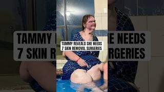 Tammy Slaton Reveals Plans for Skin Removal Surgery After 500lb Weight Loss  #shorts #1000lbsisters