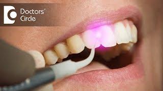 What are the Advantages of Laser Gum Treatment? - Dr. Maneesh Chandra Sharma