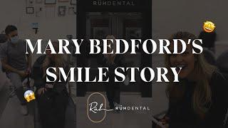 Mary Bedford's Composite Bonding Smile Transformation With Ruh Dental