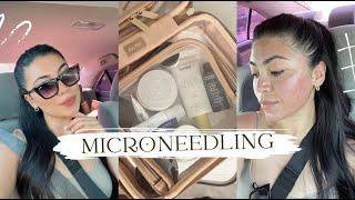 Microneedling + Skin Care Talk | Sairiitah