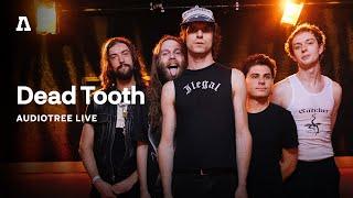 Dead Tooth on Audiotree Live (Full Session)