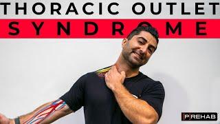 Exercises for Thoracic Outlet Syndrome