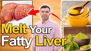 MELT YOUR FATTY LIVER - 6 Top Foods That Reverse Fatty Liver Disease And How To Fix It