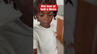 Losing Teeth in Mexico|Living in Merida Mexico