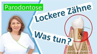 Parodontitis: Was kann man tun, wenn Zähne schon locker sind?  Zahnarztpraxis N. Redjai Großostheim