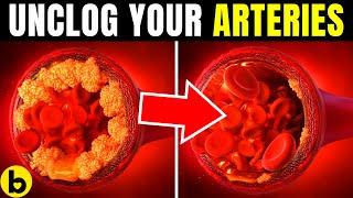 6 POWERFUL Heart Attack Preventing Foods That Can Help UNCLOG Arteries