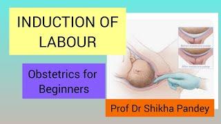 Obstetric Lecture, Induction of Labour @saisamarthgyneclasses