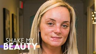 My Ex Disfigured My Face - Now I'm Helping Other Victims | SHAKE MY BEAUTY