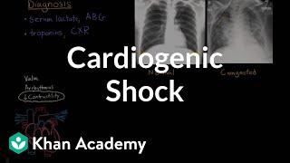 Cardiogenic shock | Circulatory System and Disease | NCLEX-RN | Khan Academy