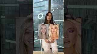 Что Алена Шишкова сделала со своим лицом?