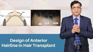 Design of Anterior Hairline in Hair Transplant | Dr. Anil Garg