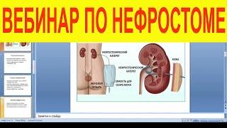 [Вебинар] Нефростома - обзор