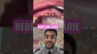 DENTISTA mostra BEBÊ todo CARIADO