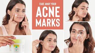 ACNE MARKS? We have the ultimate solution for CLEAR SKIN!