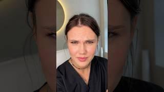 Результат ботулинотерапии спустя 14 дней