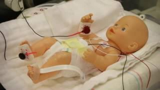 A Simple Treatment for Common Breathing Problem of Premature Infants | UCLA Health Newsroom