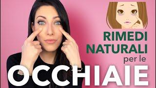 Rimedi naturali per le occhiaie 