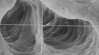 Travelling thru dentinal tubule after GentleWave