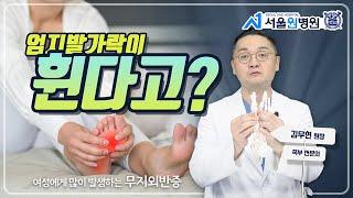 휘어진 발가락으로 고민이시라면 알아야할 것들!