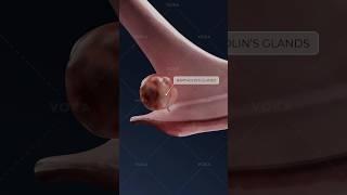 What is BARTHOLINITIS and how does it affect the vaginal area? Explore gynecology in 3D with VOKA