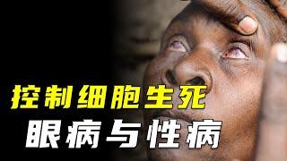 控制細胞生死，威脅1億多人，致盲的性病殺手 “沙眼” 是何方神聖？【颀思诺想】