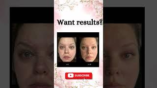 One product is enough for these issues #skincare #easyhomecareremediesforskin #viralvideo #trending