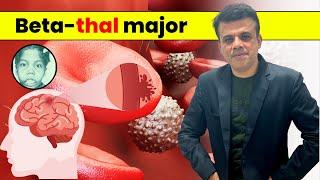 Understanding Beta Thal Major: Symptoms & Treatment| Pathology Navigator | Dr Shashikant Adlekha