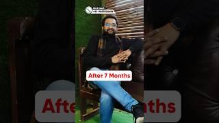 Seven Months Hair Transplant Results | Latest Fue Technique #shorts #viral #hair transplant